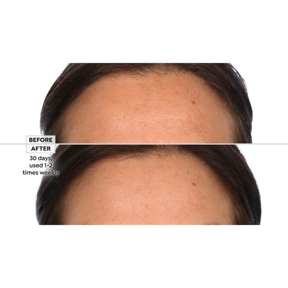 Active Argan Resurface Accelerating Peel Activated Argan Complex, 1.0 fl oz. New - Picture 4 of 16